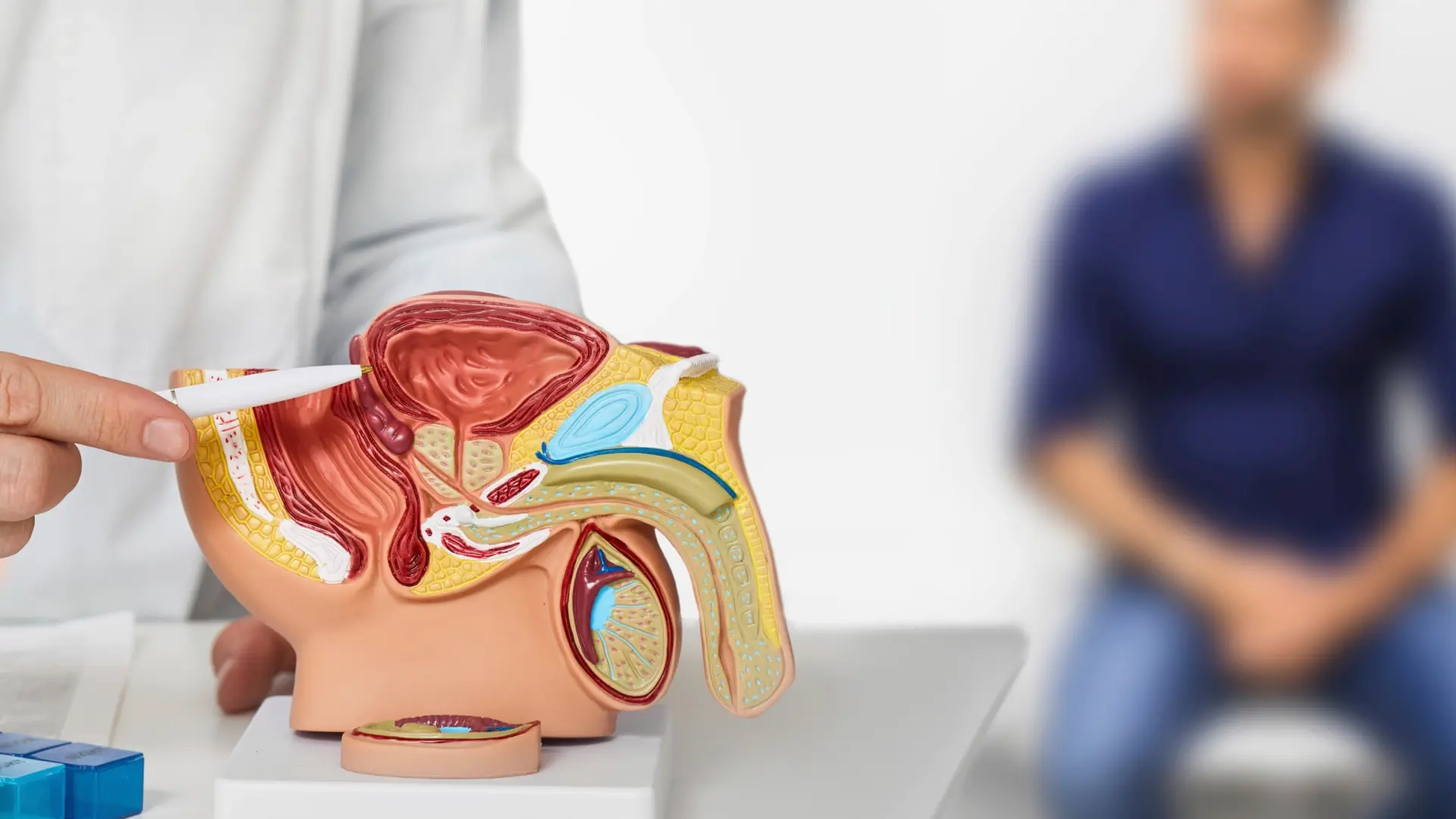 El enemigo invisible: el cáncer de próstata puede no dar síntomas y esperar a notarlos aumenta el riesgo