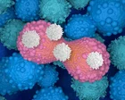 Smart drug that strips cancer cells of 'invisibility cloak' can shrink tumours by 30%, trial shows