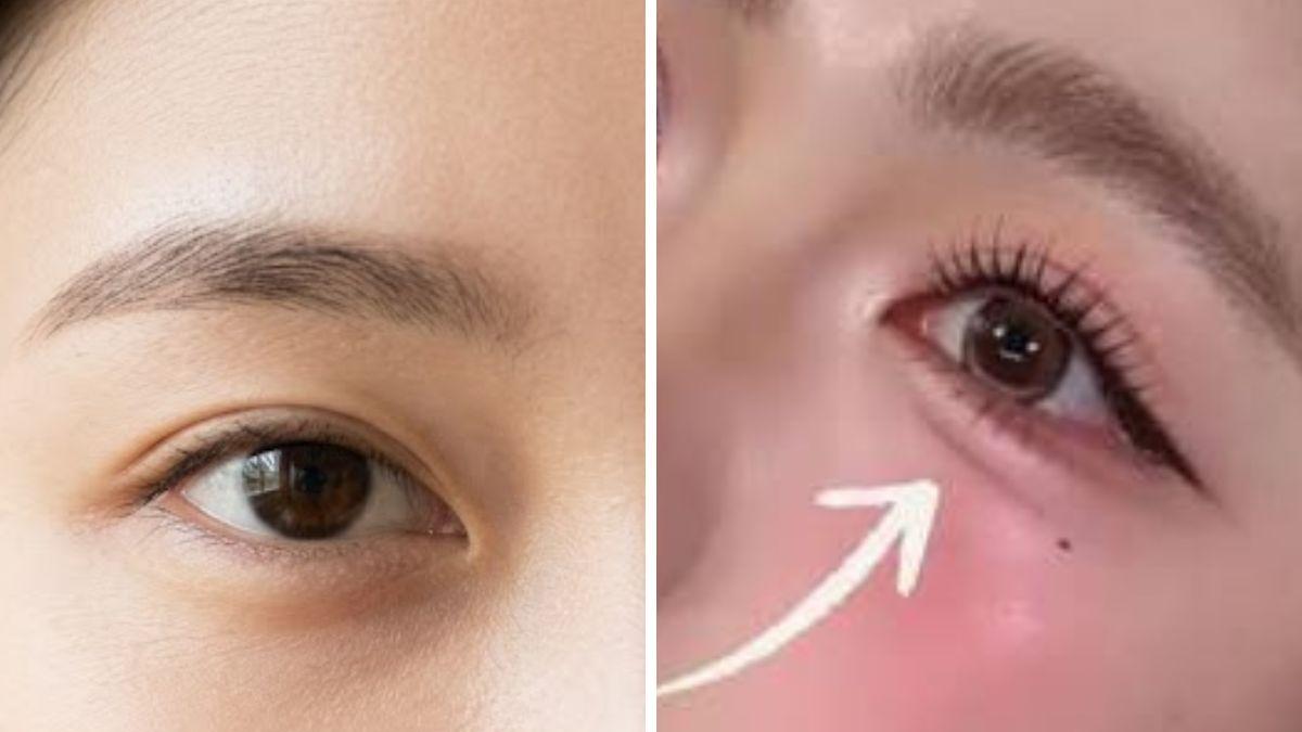 "Aegyo sal", la técnica coreana infalible que rejuvenece tu mirada