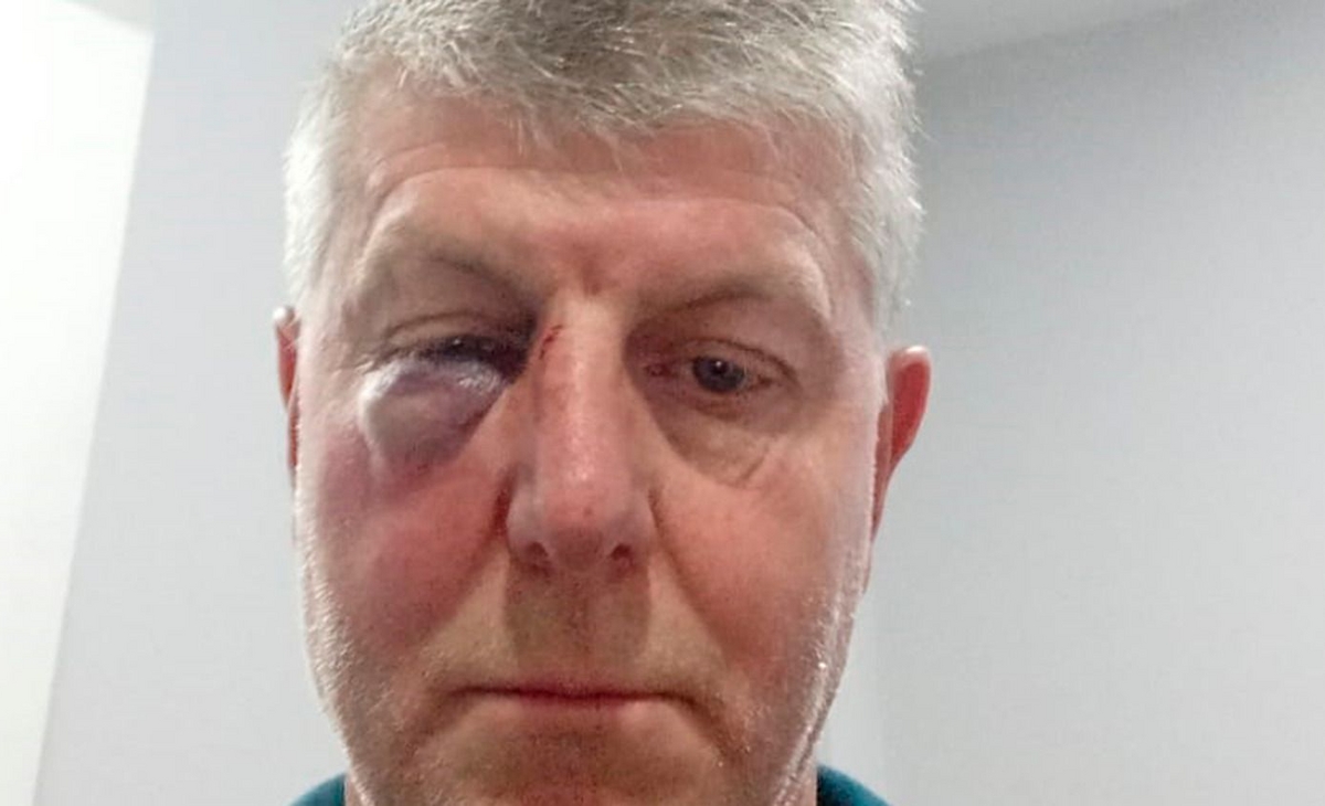 Salvaje agresión de un árbitro a un futbolista de Veteranos | La Arena - Noticias de La Pampa y el país