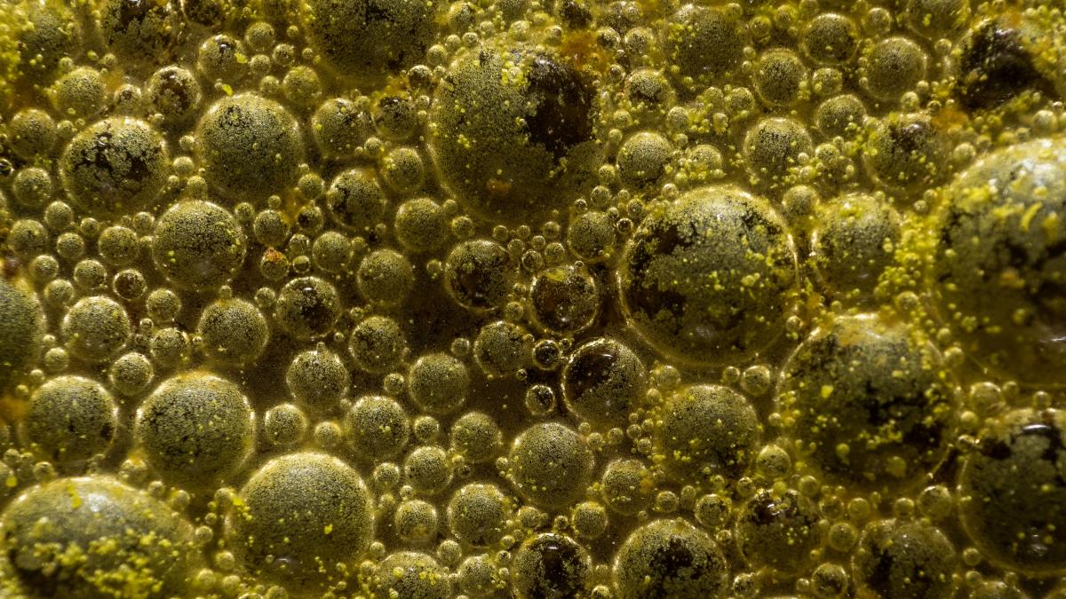Retiran FAMOSOS quesos por posible contaminación con listeria; investigan muerte