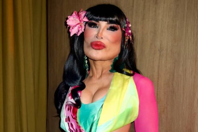 Lyn May contó la verdad de la transformación de su rostro: "Terrible". Así se veía antes