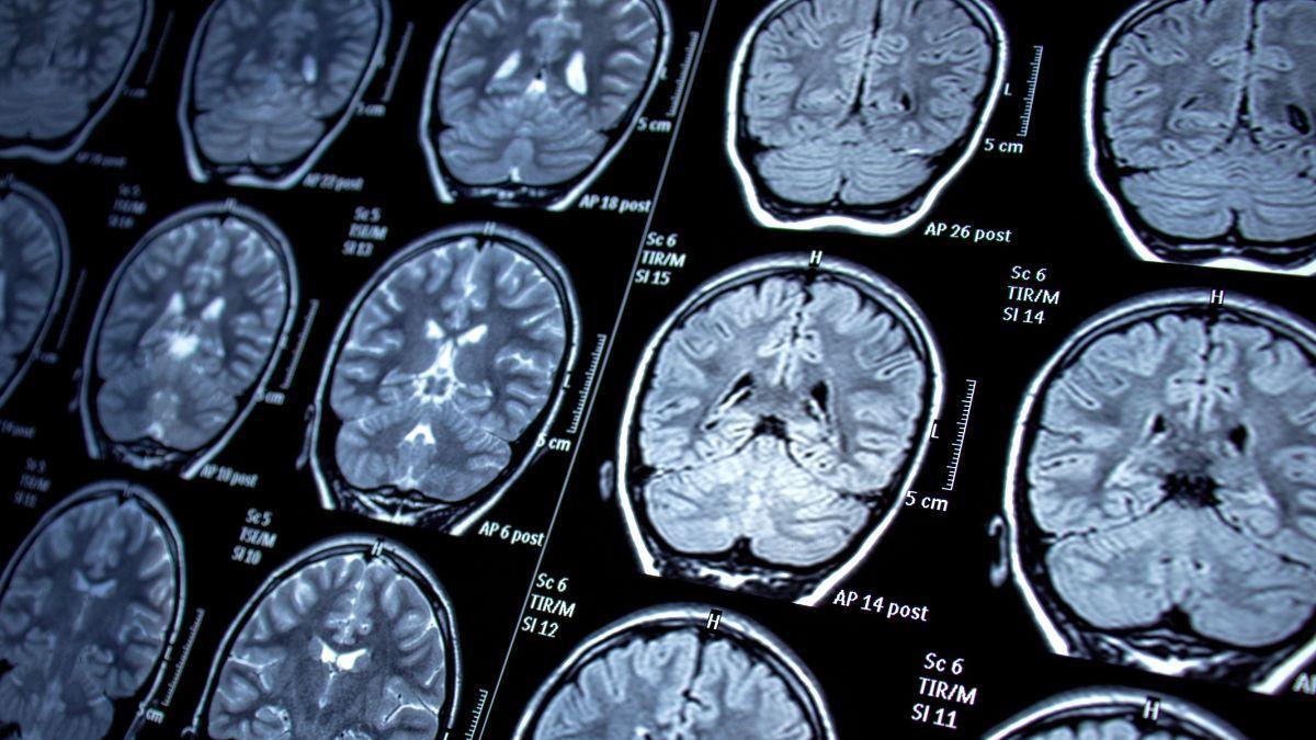 Convulsiones febriles: señales de alerta y primeros pasos para ayudar a tu hijo