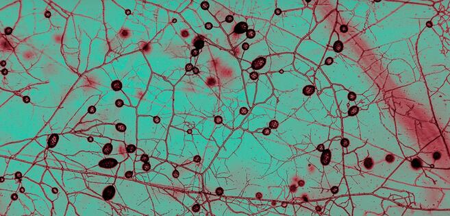 Primer mapa global muestra la inmensa red de hongos oculta en los suelos