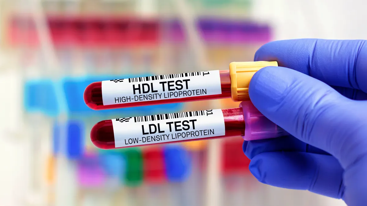Colesterol alto: por qué se puede tener aún con peso saludable y ejercicio
