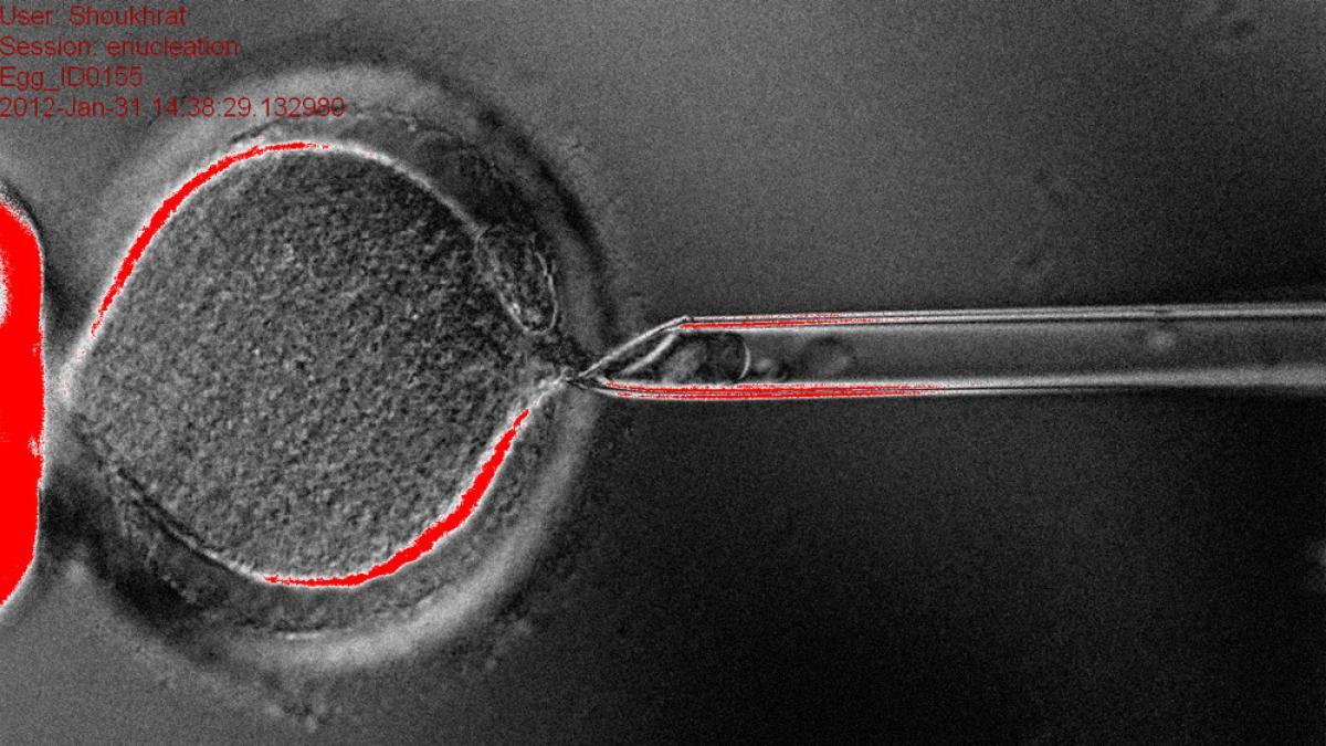 Los científicos editan por primera vez de forma precisa los genes de embriones humanos