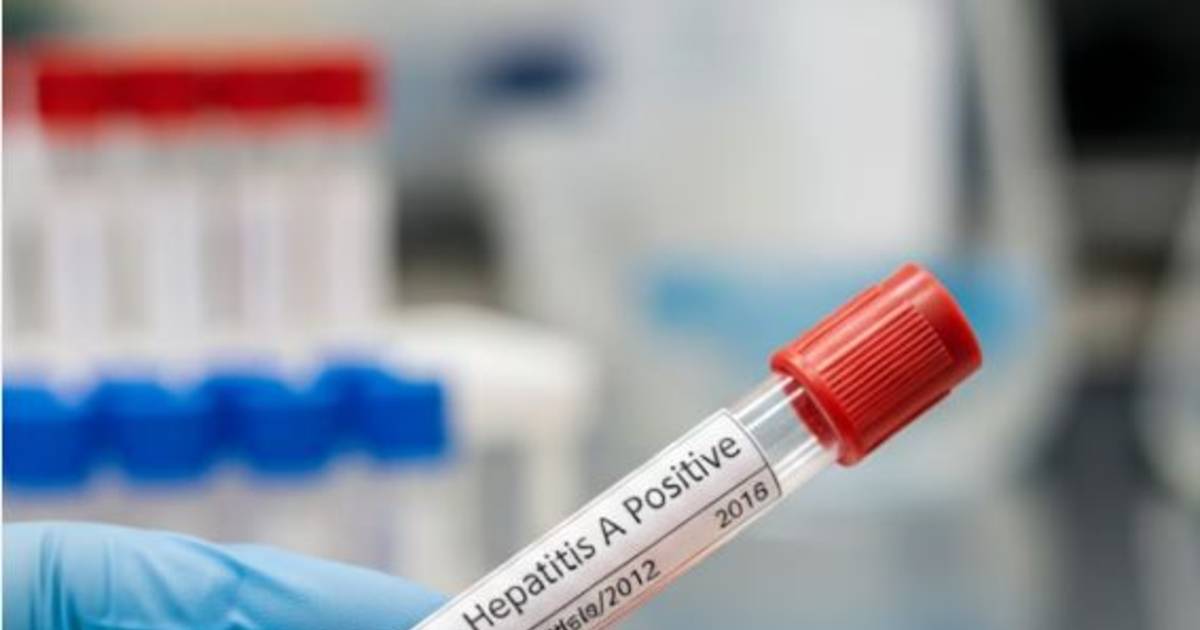 Crecen los casos de hepatitis A en el país y encontraron otro virus poco conocido