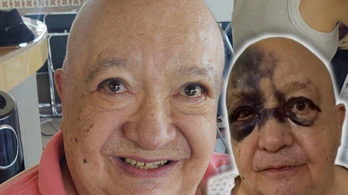 Luis de Alba sufre accidente: esposa del actor revela el estado de salud de