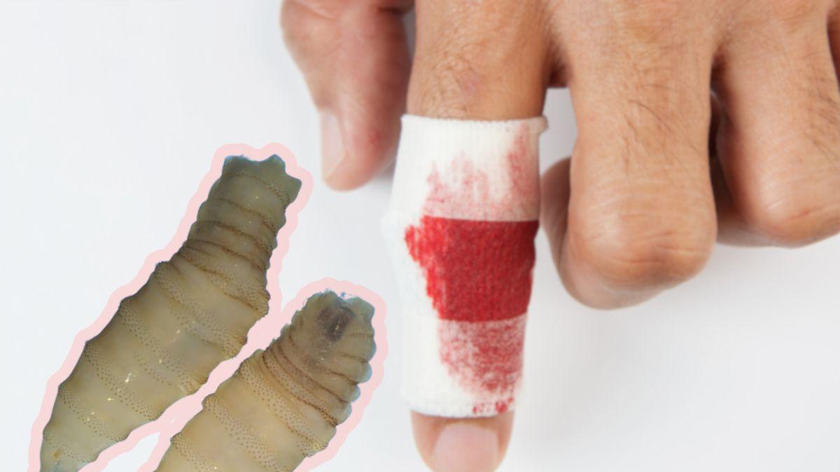 ¿Sientes algo moverse bajo tu piel? Los síntomas del gusano barrenador en humanos: