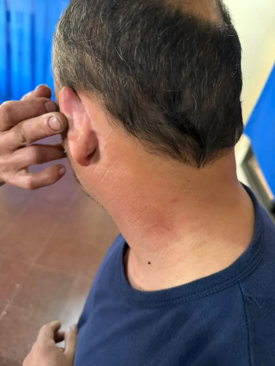 Posadeño denunció recibir una golpiza por parte de policías durante un control de tránsito
