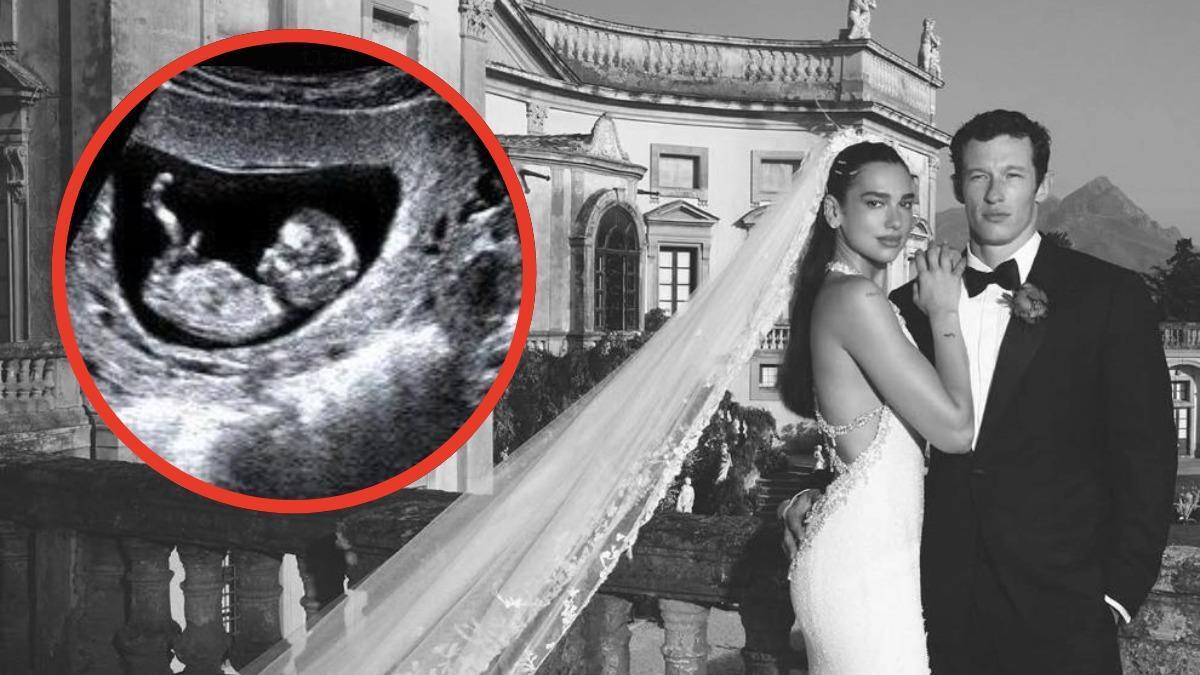 ¿Dua Lipa está embarazada? La verdad detrás del rumor tras publicar fotos de su boda