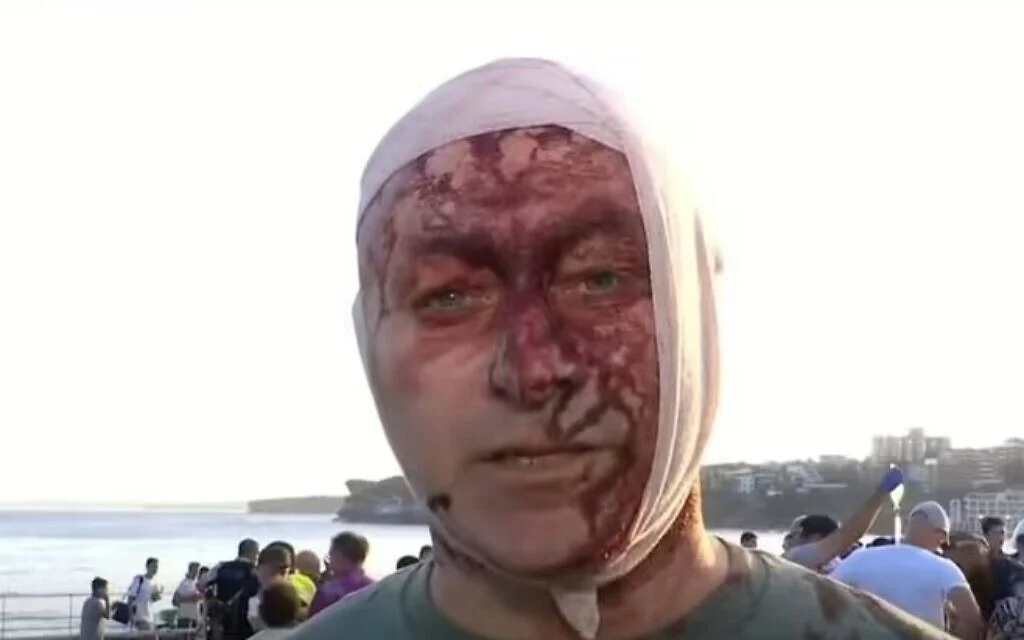 Bondi survivor tells Australian commission he was accused of being AI 'crisis actor'
