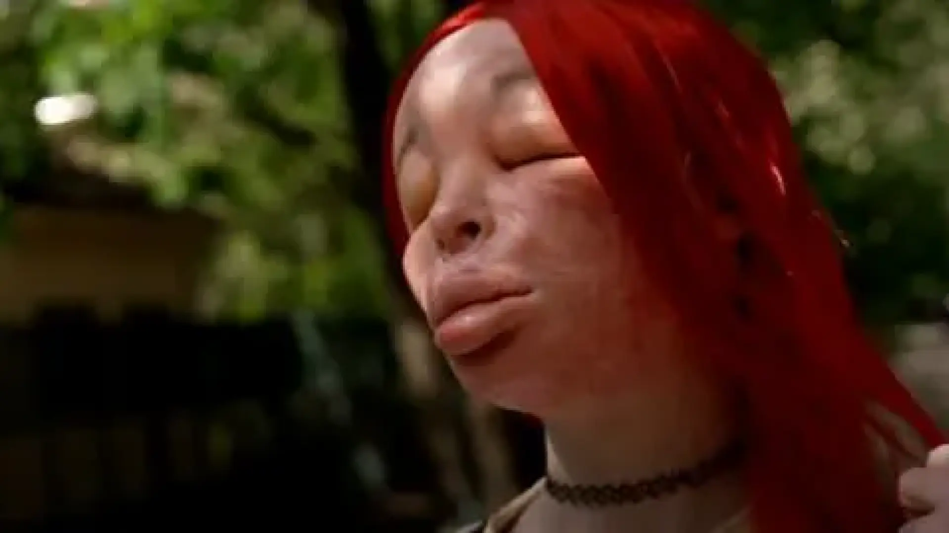 Una joven acaba con la cara totalmente desfigurada tras inyectarse silicona de manera clandestina