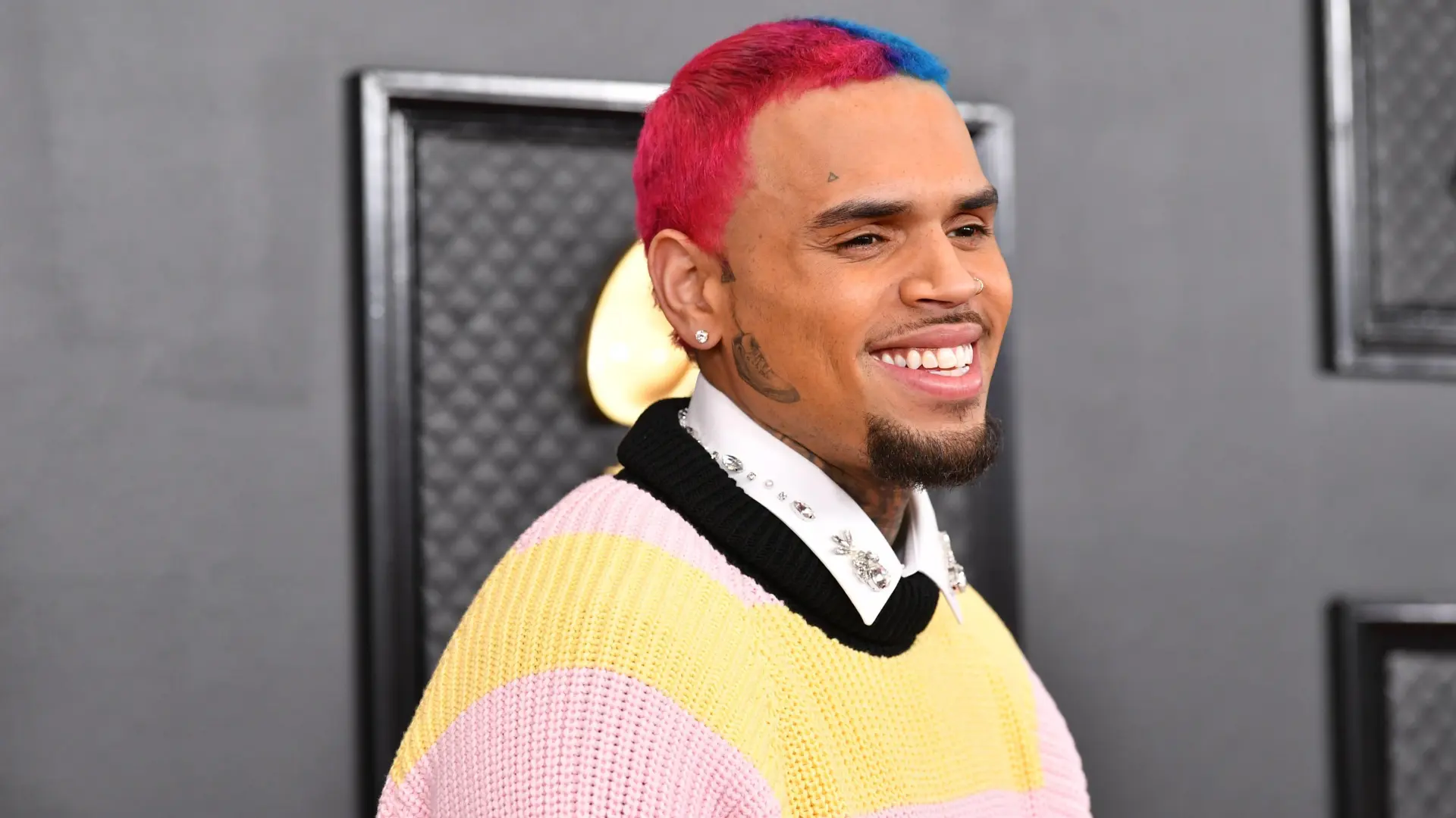 Las impactantes imágenes del ataque de uno de los perros de Chris Brown a su empleada