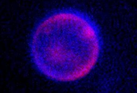 Las nuevas células sintéticas no son vida artificial, pero son importantes